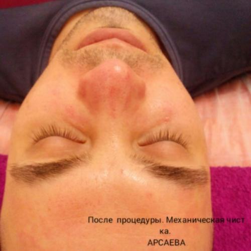 Требуются модели. Депиляция: 04 Требуются модели. Депиляция: 04