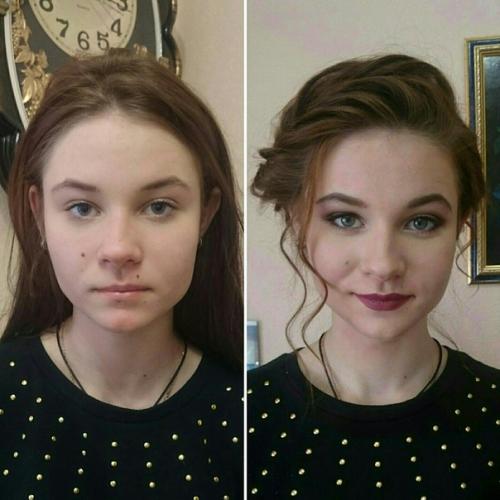 Epilage - cенсация 2017 года? 03