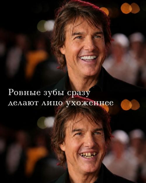 Улыбка - это не мелочь, а деталь, которая меняет весь образ человека. 01