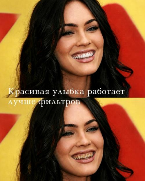 Улыбка - это не мелочь, а деталь, которая меняет весь образ человека. 02