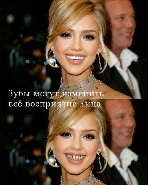 Улыбка - это не мелочь, а деталь, которая меняет весь образ человека. 03