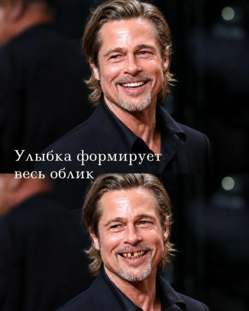 Улыбка - это не мелочь, а деталь, которая меняет весь образ человека. 04
