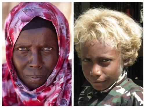 Любителям Определи МОЙ Расовый Фенотип посвящается. 03 Любителям Определи МОЙ Расовый Фенотип посвящается. 03