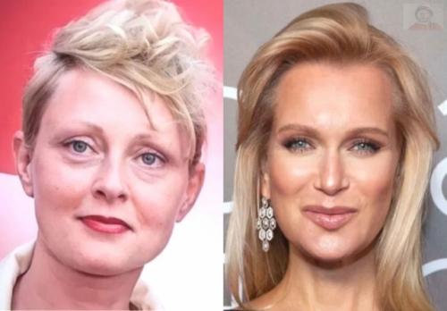 Когда время не щадит: почему звёзды - ровесники выглядят так по-разному? 03 Когда время не щадит: почему звёзды - ровесники выглядят так по-разному? 03