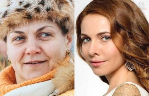 Когда время не щадит: почему звёзды - ровесники выглядят так по-разному? 08 Когда время не щадит: почему звёзды - ровесники выглядят так по-разному? 08